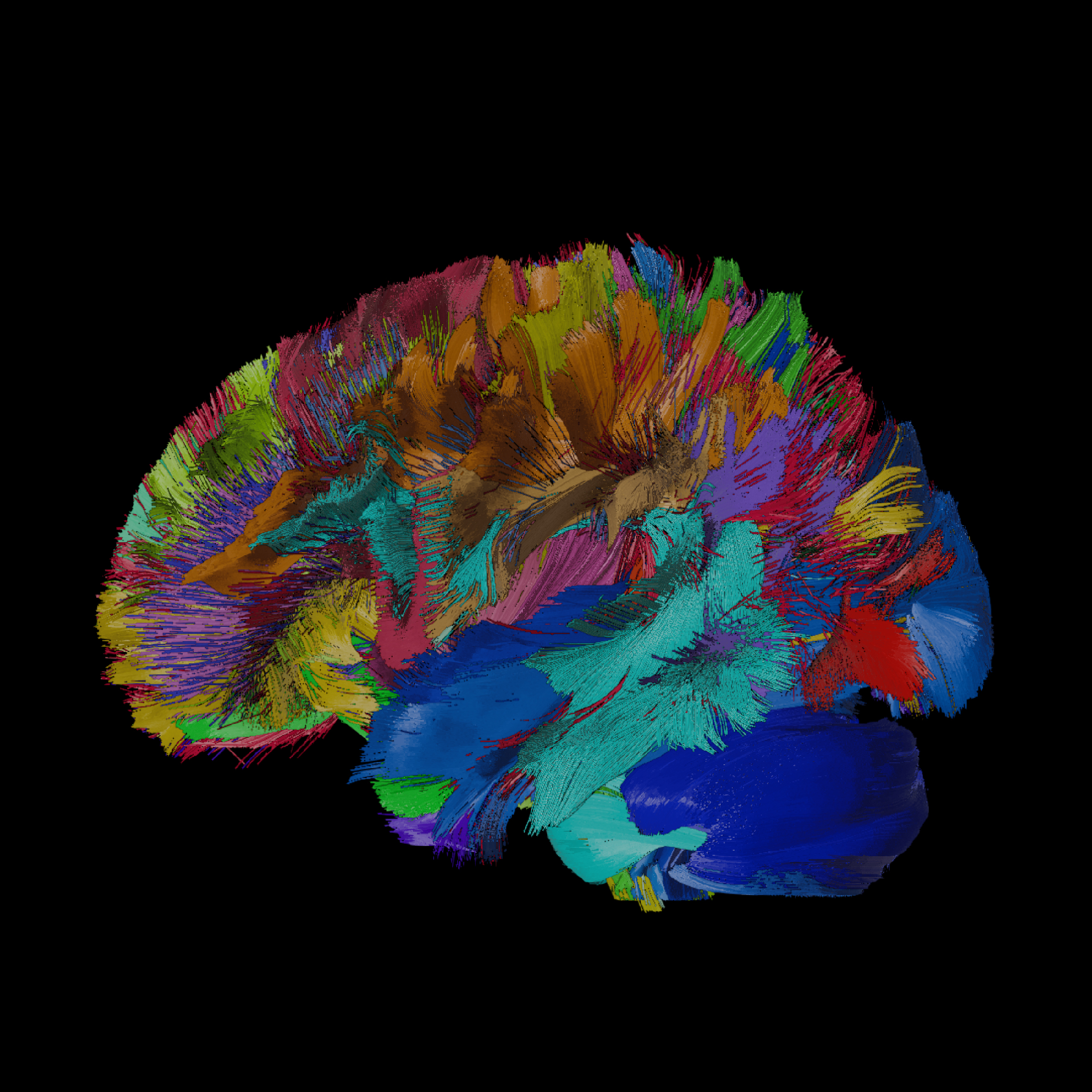 Brain tractogram showing white matter tracts