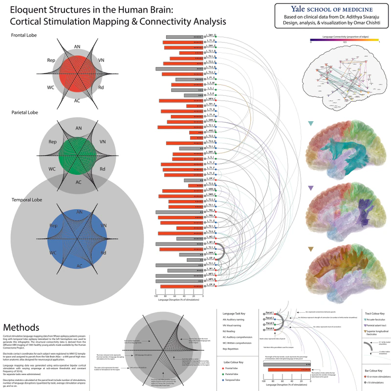 Original white-background version of the brain network poster