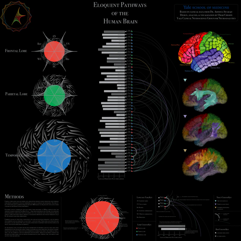 Brain network visualisation poster